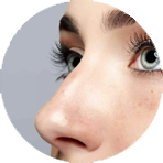 nostril-c.rhinoplasty-surgeon-perth
