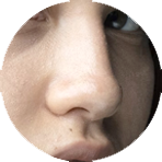 rhinoplasty-c.rhinoplasty-surgeon-perth